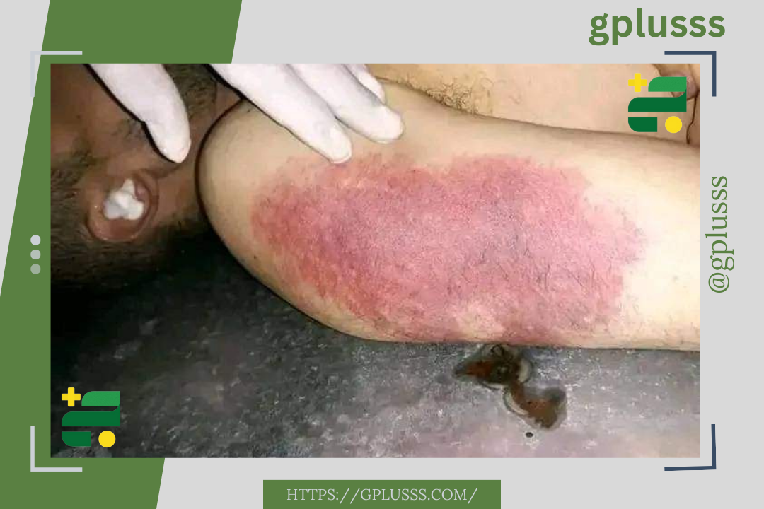 عمر العنيزي البرغثي