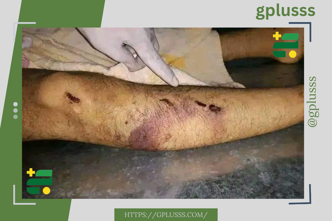 عمر العنيزي البرغثي